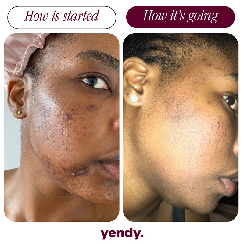 4-Step Radiant Skin Kit